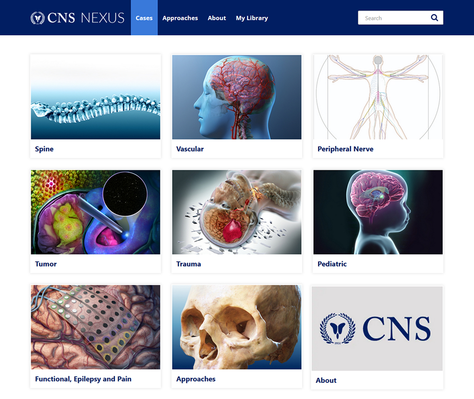 Nexus interface showing Cases criteria